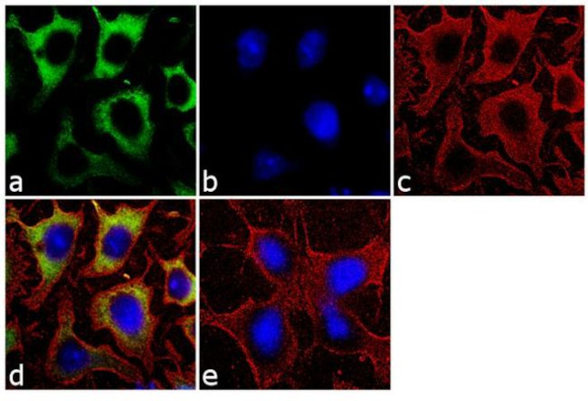 Placental Alkaline Phosphatase Antibody in Immunocytochemistry (ICC/IF)