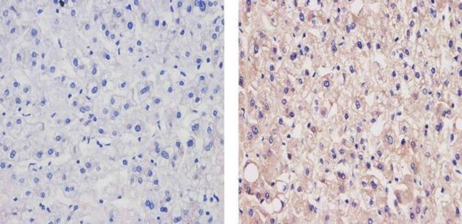 Apolipoprotein B Antibody in Immunohistochemistry (Paraffin) (IHC (P))