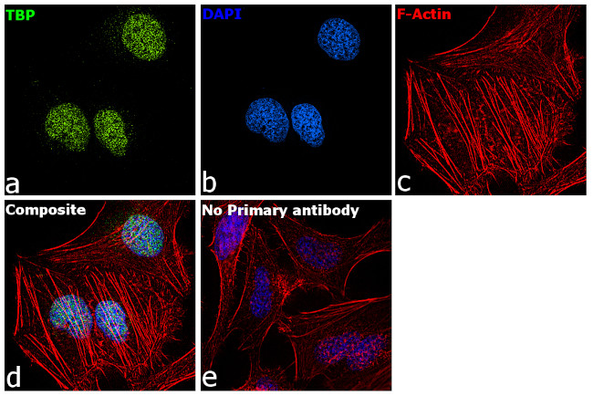 TBP Antibody in Immunocytochemistry (ICC/IF)