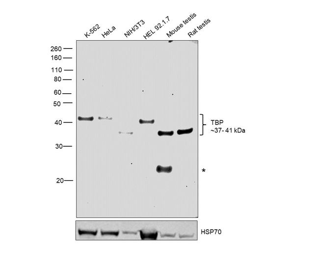 TBP Antibody in Western Blot (WB)