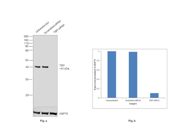 TBP Antibody