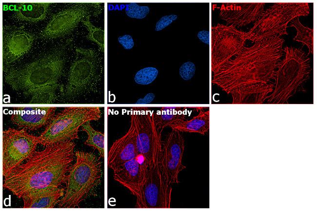 Bcl-10 Antibody in Immunocytochemistry (ICC/IF)