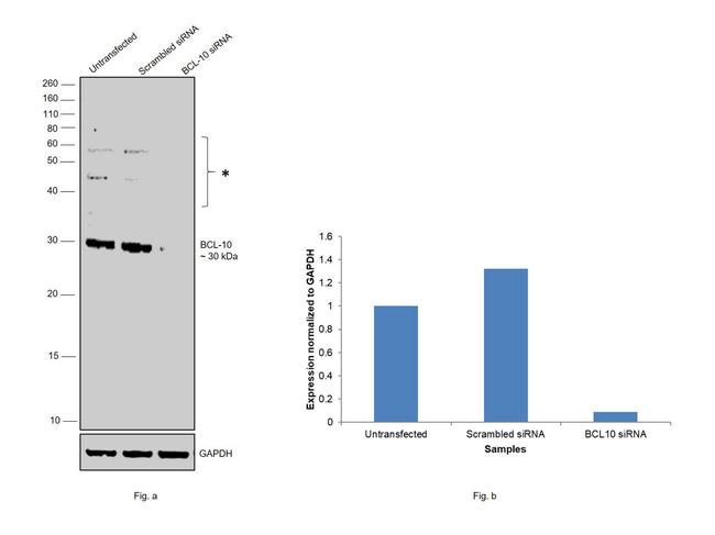 Bcl-10 Antibody in Western Blot (WB)