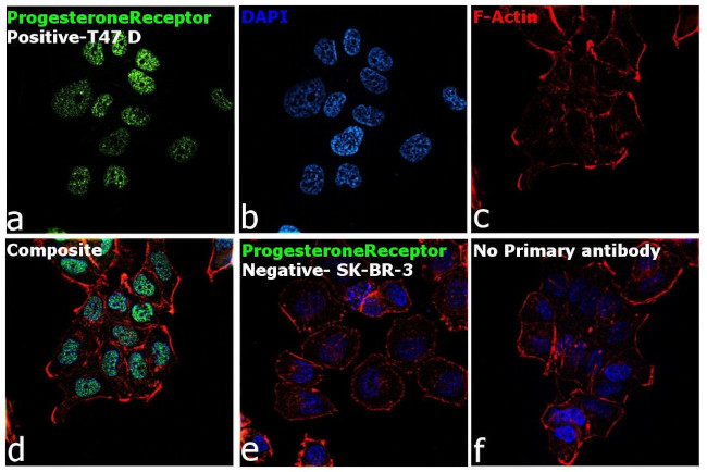 Progesterone Receptor Antibody in Immunocytochemistry (ICC/IF)