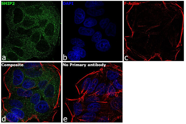 SHIP2 Antibody in Immunocytochemistry (ICC/IF)