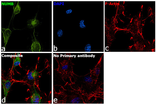 NUMB Antibody in Immunocytochemistry (ICC/IF)