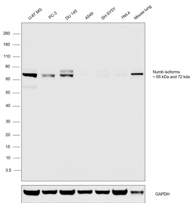 NUMB Antibody in Western Blot (WB)