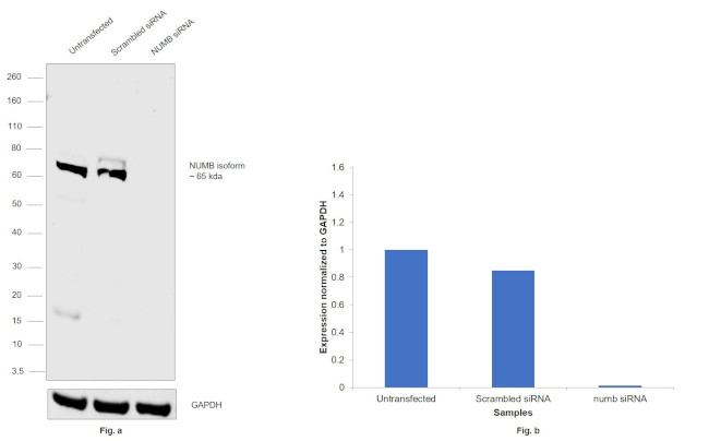 NUMB Antibody