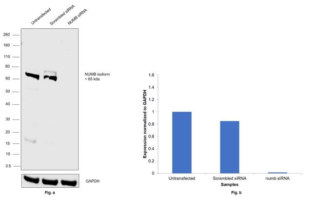 NUMB Antibody in Western Blot (WB)