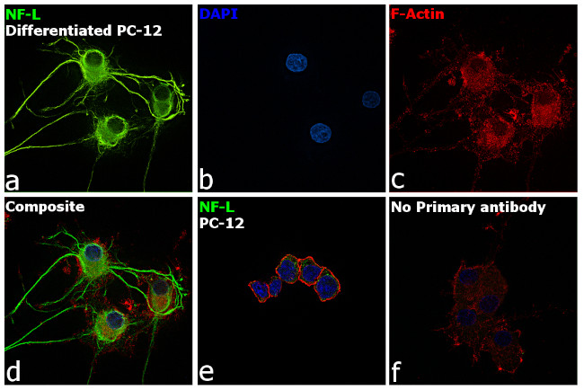 NEFL Monoclonal Antibody (T.400.5) (MA5-14981)