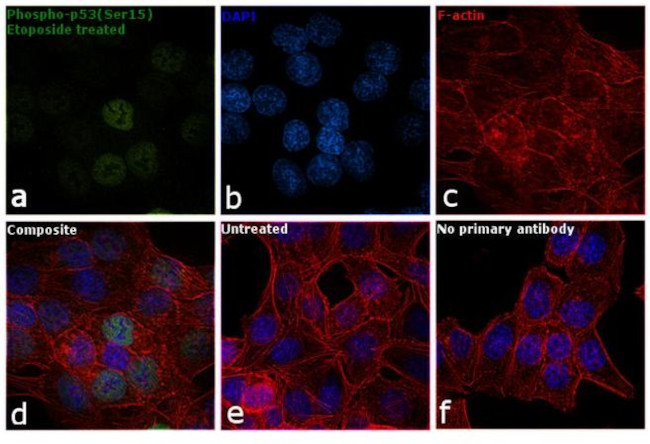 Phospho-p53 (Ser15) Antibody in Immunocytochemistry (ICC/IF)