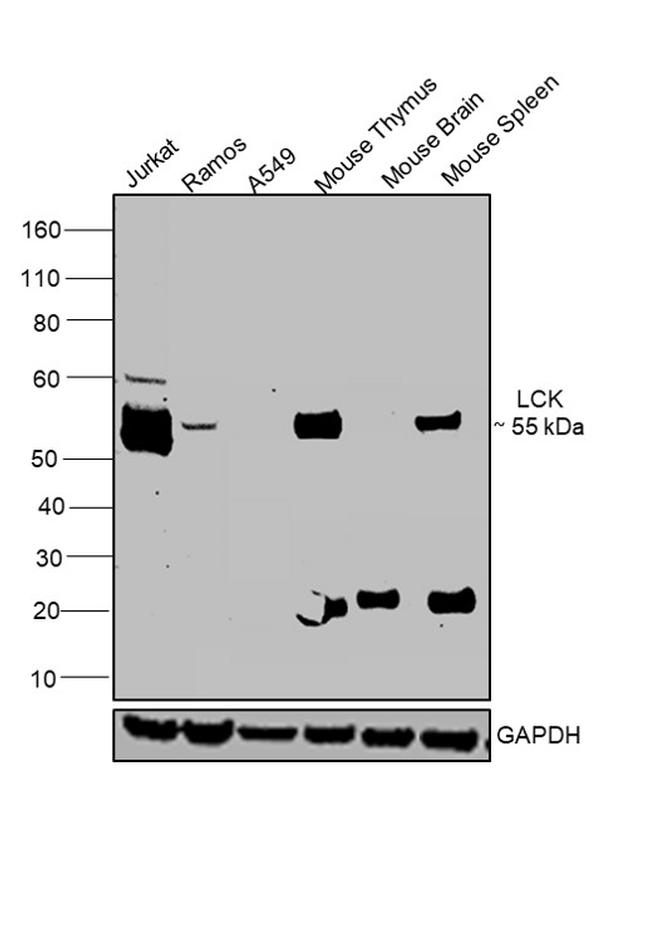 LCK Antibody in Western Blot (WB)