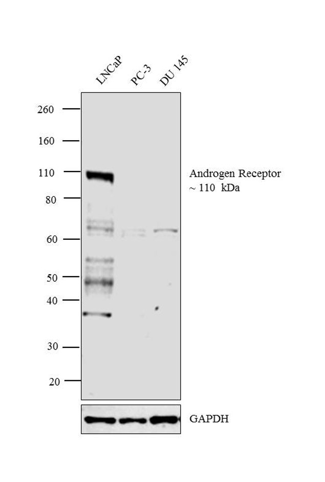 Androgen Receptor Antibody