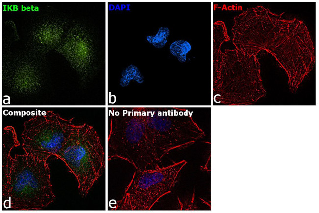 IkB beta Antibody in Immunocytochemistry (ICC/IF)