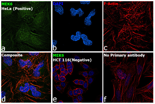 MEK6 Antibody in Immunocytochemistry (ICC/IF)