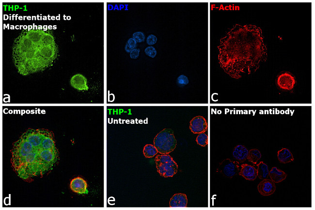 MMP9 Antibody in Immunocytochemistry (ICC/IF)