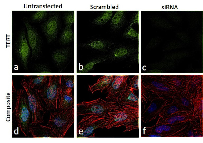 TERT Antibody in Immunocytochemistry (ICC/IF)