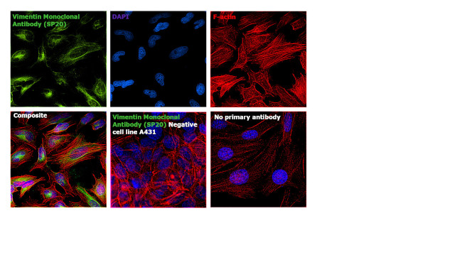 Vimentin Antibody in Immunocytochemistry (ICC/IF)