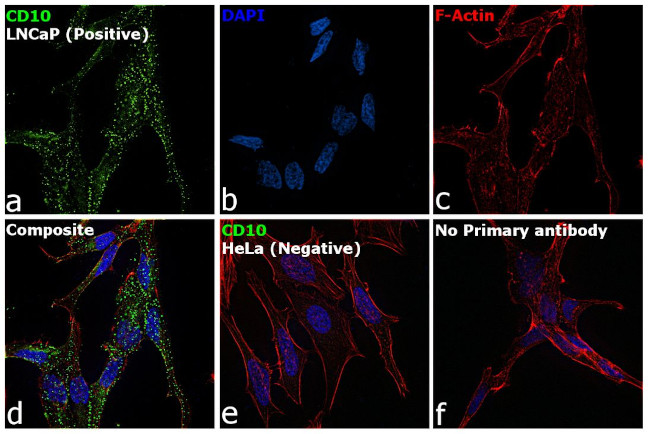 CD10 Antibody