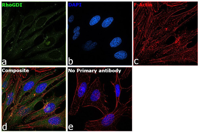 RhoGDI Antibody in Immunocytochemistry (ICC/IF)