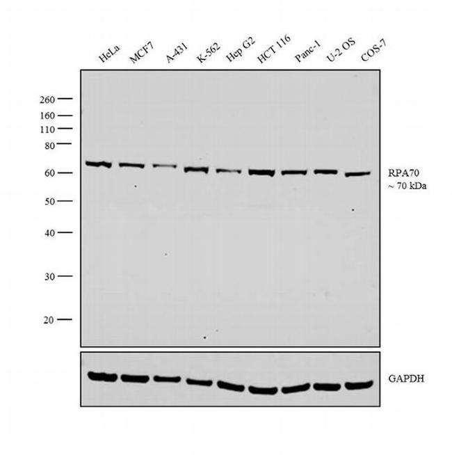 RPA70 Antibody in Western Blot (WB)