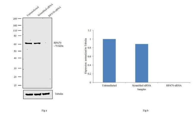 RPA70 Antibody in Western Blot (WB)