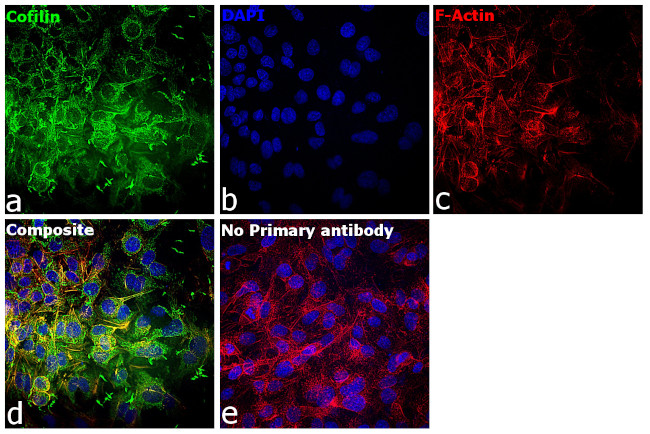 Cofilin Antibody in Immunocytochemistry (ICC/IF)