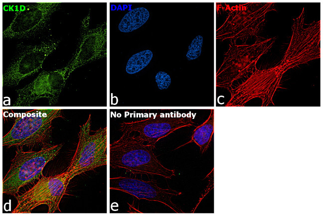 CK1 delta Antibody in Immunocytochemistry (ICC/IF)