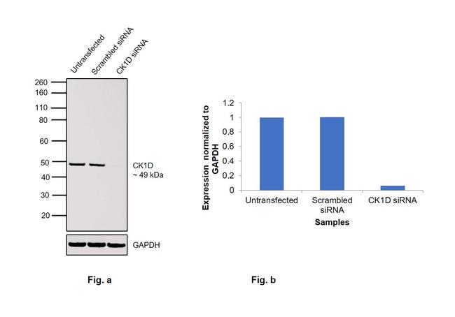 CK1 delta Antibody in Western Blot (WB)