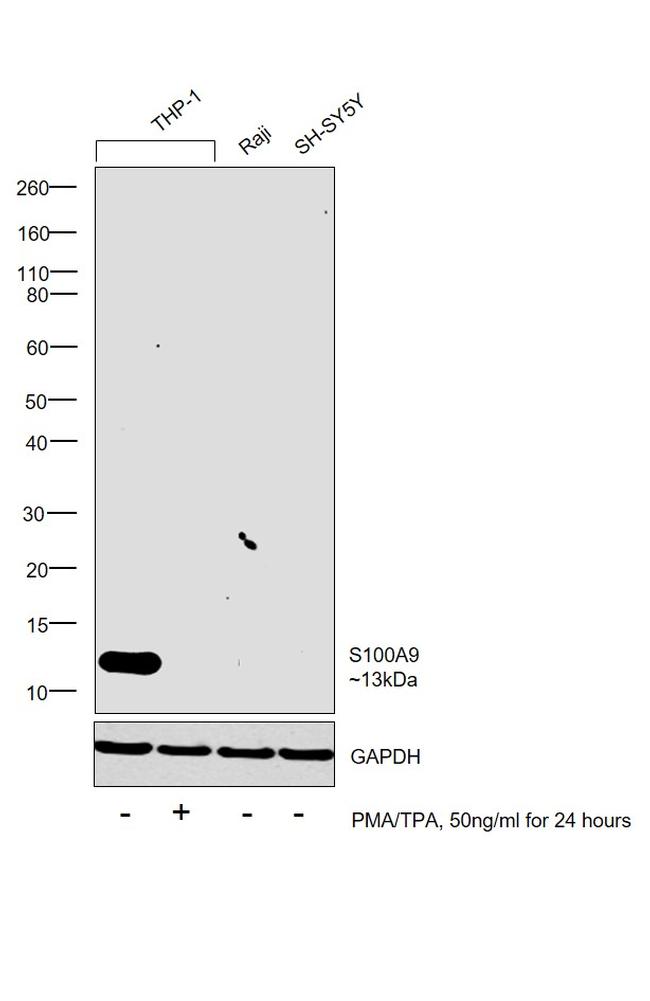 S100A9 Antibody in Western Blot (WB)