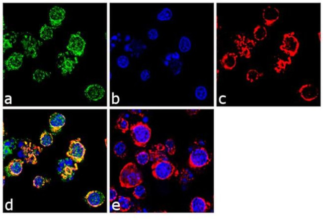 CD11a Antibody in Immunocytochemistry (ICC/IF)