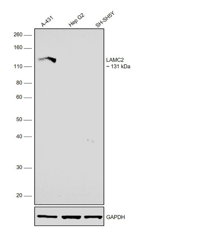 Laminin gamma-2 Antibody in Western Blot (WB)