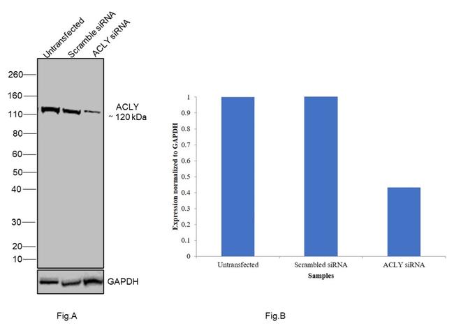 ATP Citrate Lyase Antibody in Western Blot (WB)