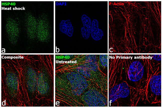 HSP40 Antibody in Immunocytochemistry (ICC/IF)