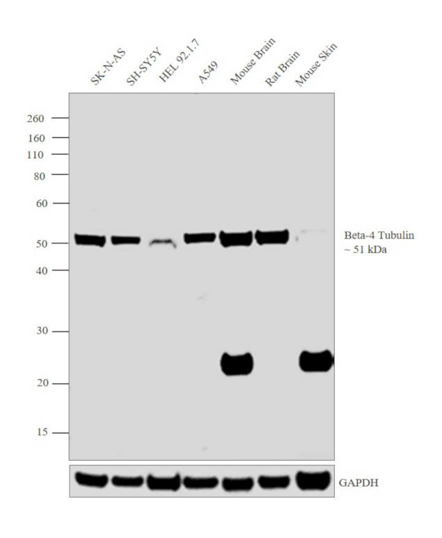 beta-4 Tubulin Antibody