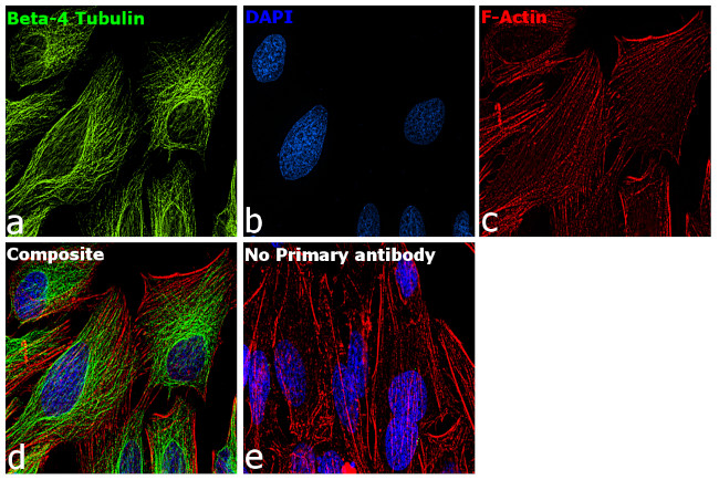 beta-4 Tubulin Antibody in Immunocytochemistry (ICC/IF)