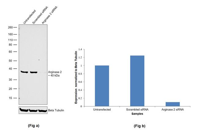 Arginase 2 Antibody in Western Blot (WB)