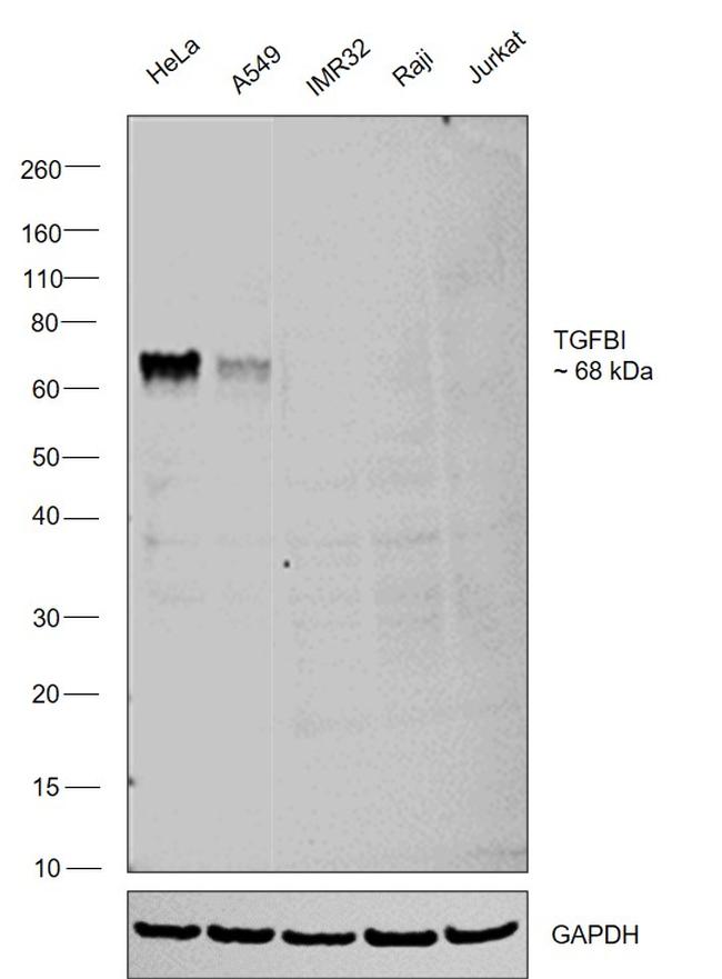 TGFBI Antibody in Western Blot (WB)