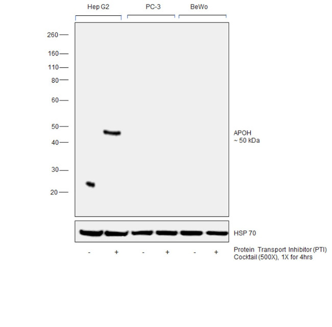Apolipoprotein H Monoclonal Antibody (OTI2C9) (MA5-26847)