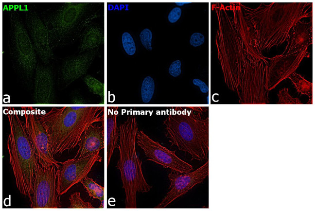 APPL1 Antibody in Immunocytochemistry (ICC/IF)