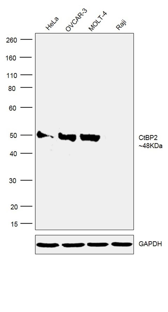 CtBP2 Antibody in Western Blot (WB)