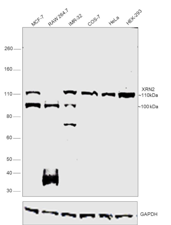 XRN2 Antibody in Western Blot (WB)