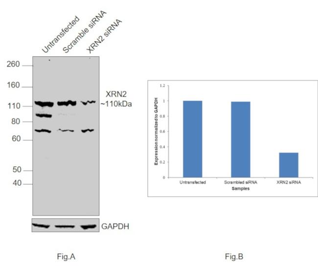 XRN2 Antibody in Western Blot (WB)