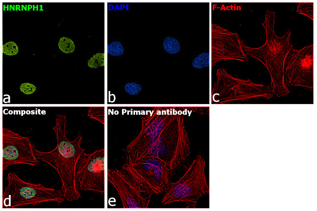 hnRNP H1 Antibody in Immunocytochemistry (ICC/IF)