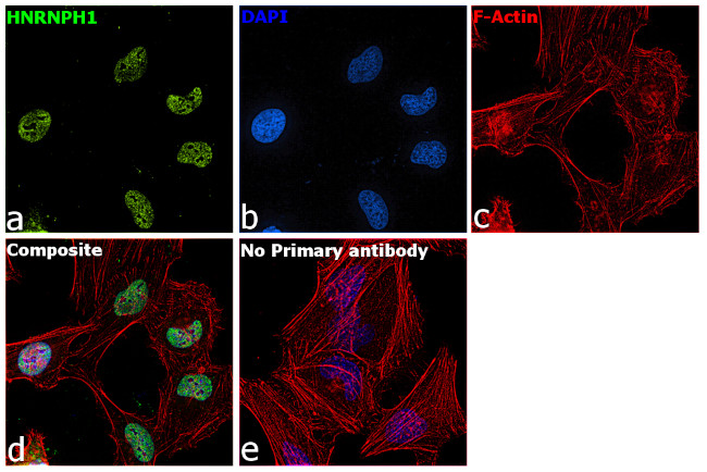 hnRNP H1 Antibody in Immunocytochemistry (ICC/IF)