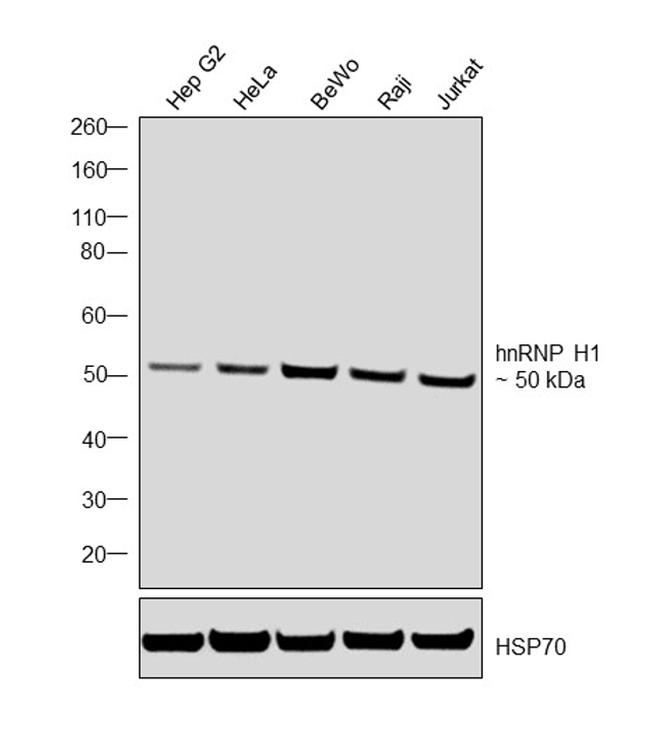 hnRNP H1 Antibody in Western Blot (WB)