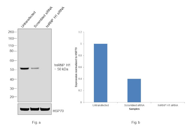 hnRNP H1 Antibody