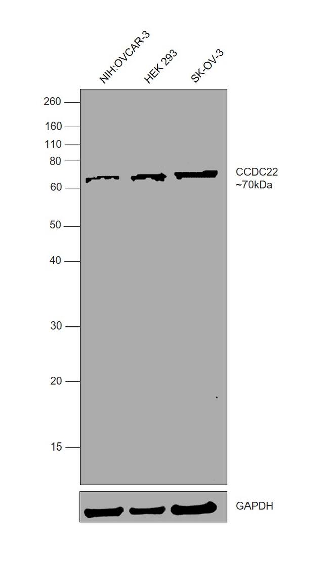 CCDC22 Antibody in Western Blot (WB)