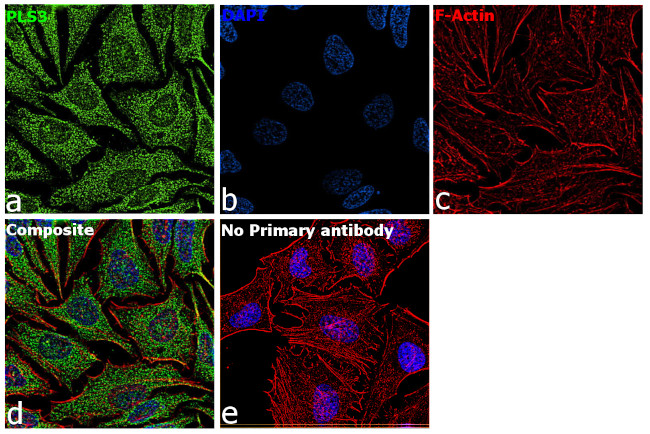 PLS3 Antibody in Immunocytochemistry (ICC/IF)