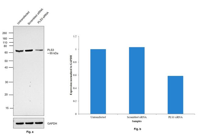 PLS3 Antibody in Western Blot (WB)